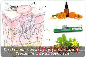 Когда появились полипы и папилломы. | Женский мир