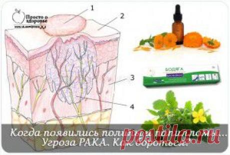 Когда появились полипы и папилломы. | Женский мир