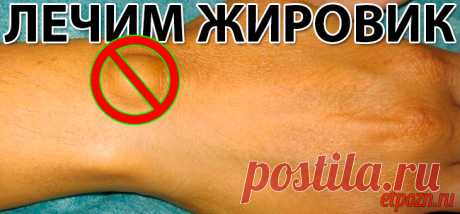 ЛЕЧИМ ЖИРОВИК | Это Полезно Знать Наверняка многие из вас знают, что такое жировик. Это безболезненная шишка на теле, которая кроме неэстетичного вида никаких неудобств не приносит. Она просто есть и многие с ней смиряются и живут с ней годами....