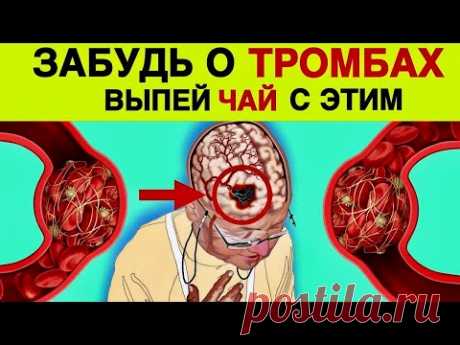 РАЗЖИЖАЮТ ЛУЧШЕ АСПИРИНА | НАВСЕГДА ЗАБУДЬ о ТРОМБАХ и ГУСТОЙ КРОВИ