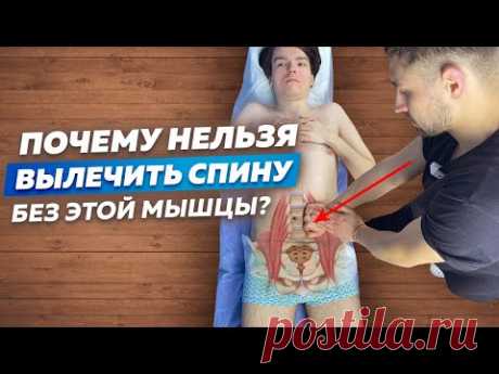 Подвздошно-Поясничная Мышца. ТАЙНА БОЛЕЙ В СПИНЕ!