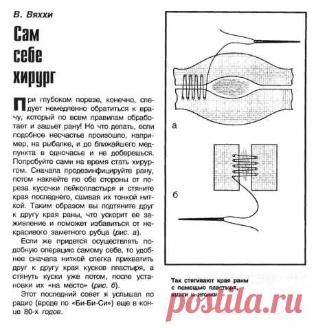 Сам себе хирург (журнал Сделай сам (Огонек) № 06, 1993 год, стр. 58)