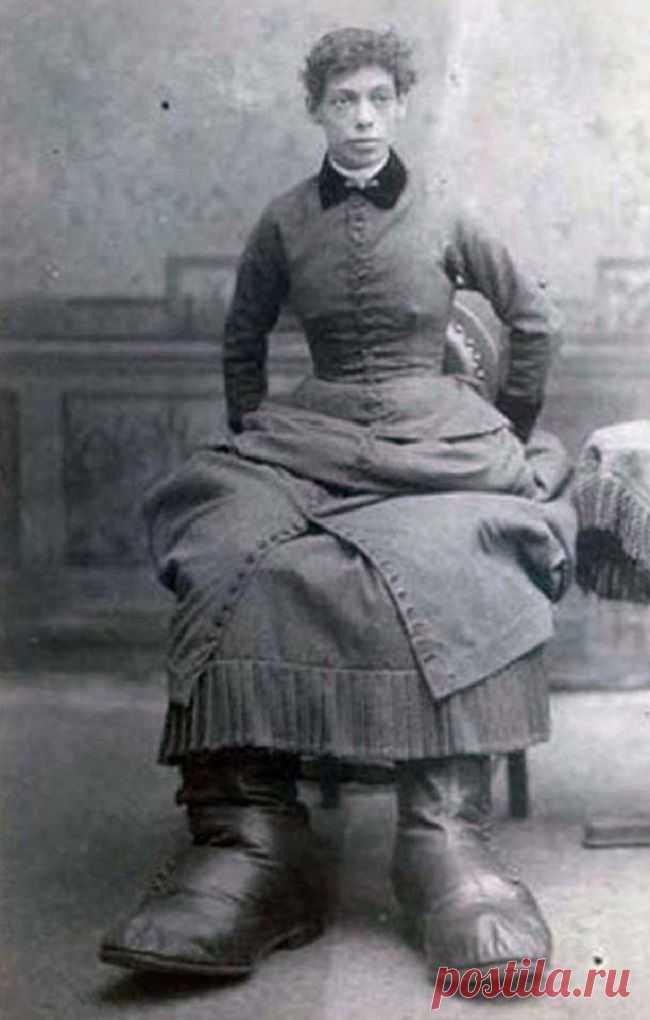 Трудно поверить, но эти 5 человек с аномалиями действительно существовали! Их истории невероятны...