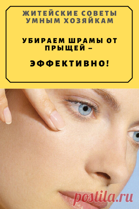 Убираем шрамы от прыщей – эффективно! | Житейские Советы