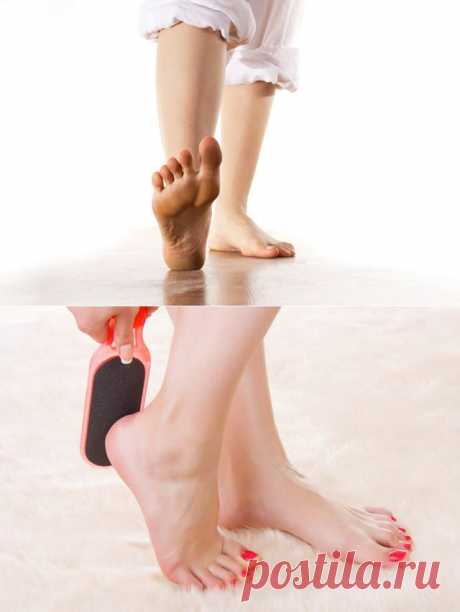 Мозоли, натоптыши, трещины: как избежать проблем с ногами? / Будьте здоровы