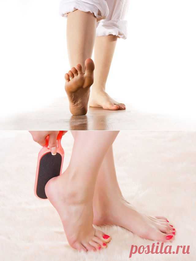 Мозоли, натоптыши, трещины: как избежать проблем с ногами? / Будьте здоровы