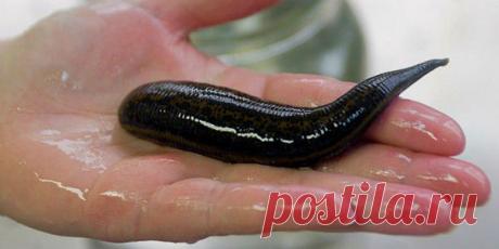 Лечение пиявками показания и противопоказания, гирудотерапия при варикозе — Здоровое питание и фитнес