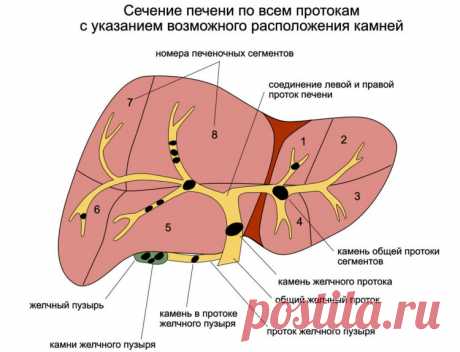 Камни в печени и желчном пузыре: причины возникновения и способы выведения - Центр реабилитационной энергетики