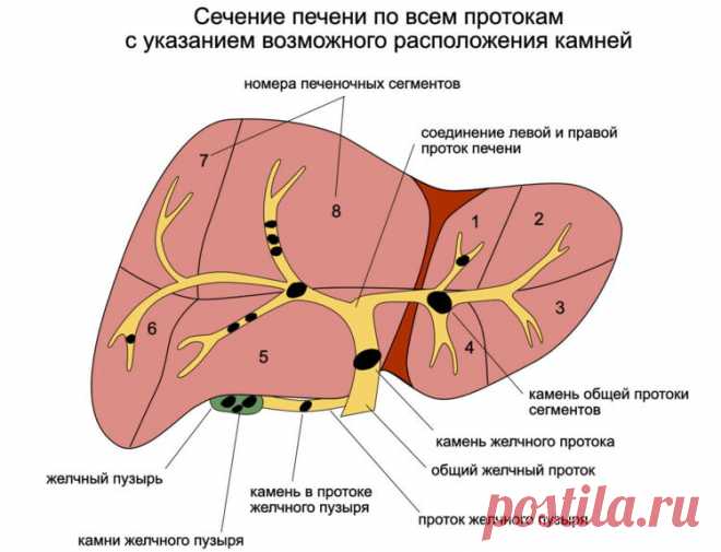 Камни в печени и желчном пузыре: причины возникновения и способы выведения - Центр реабилитационной энергетики