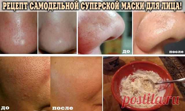 Всё самое интересное!: МАСКА ОТ ЧЁРНЫХ ТОЧЕК. 100%-Й ЭФФЕКТ!