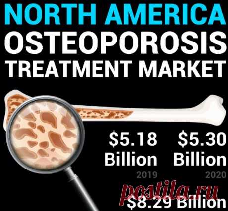 The North America Osteoporosis Treatment Market was valued at USD 5.18 billion in 2019 and is anticipated to increase from USD 5.30 billion in 2020 to USD 8.29 billion in 2027, at a CAGR of 6.6%.