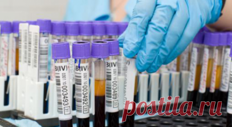 Биохимический анализ крови: расшифровка, норма