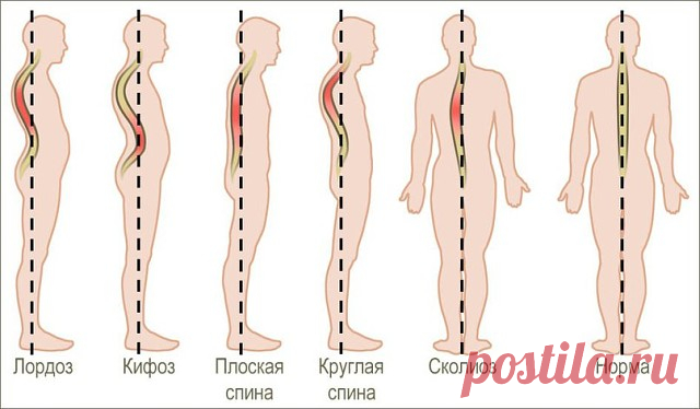(53) Одноклассники