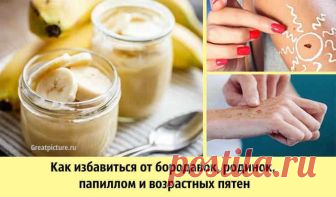Как избавиться от бородавок, родинок, папиллом и возрастных пятен Как избавиться от бородавок, родинок,папиллом и возрастных пятен. Мы представляем вам несколько народных средств, которые помогут решить ваши