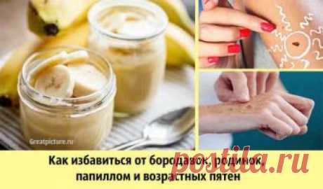 как удалить с тела папилломы народными средствами	Перед тем как удалить папилломы в домашних условиях, требуется грамотно подобрать лечащее средство, изучить инструкцию.Народные средства от папиллом. Успешно бороться с вирусом и выводить с тела некрасивые отростки можно альтернативными методами.
