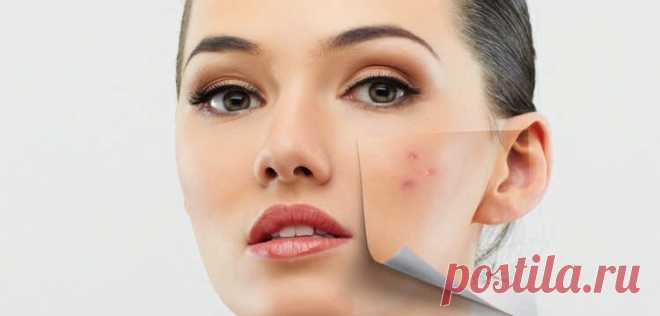 Как избавиться от папиллом на лице дома - Отлично выглядишь
