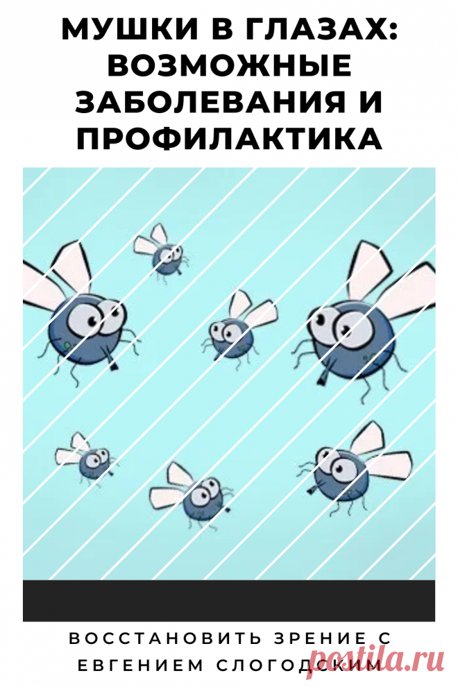 Мушки в глазах что это такое Зуд сухость глаз Деструкция стекловидного тела Как избавиться от плавающих мушек Нарушение зрения Вернуть зрение Помутнения перед глазами причины и лечение Средства для улучшения зрения Упражнения для глаз Мушки в глазах исчезают навсегда Плавающие помутнения точки паутинки перед глазами Болезни глаз Возрастное изменение Заболевания сетчатки Устают глаза Боль Плохое зрение Восстановить зрение с Евгением Слогодским без операции Гимнастика тренажёр для глаз Миодезопсия