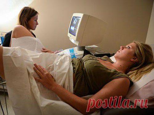 Забыли спросить: врач-гинеколог прокомментировала запрет бесплатных абортов - МедНовости - MedPortal.ru