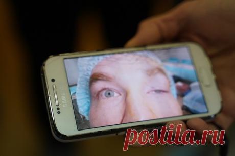 Самарские врачи за полчаса «открыли» глаз итальянцу
Флавио Фриджерио много лет страдал из-за старой детской травмы, но европейские медики ничего не могли поделать Миланец Флавио Фриджерио долгие 25 лет видел окружающий мир только «вполглаза». Виной всему был птоз – опущение верхнего века. В 10-летнем возрасте он получил травму – неудачно упал и дужкой очков повредил мышцу над левым глазом. С тех пор […]
Читай дальше на сайте. Жми подробнее ➡