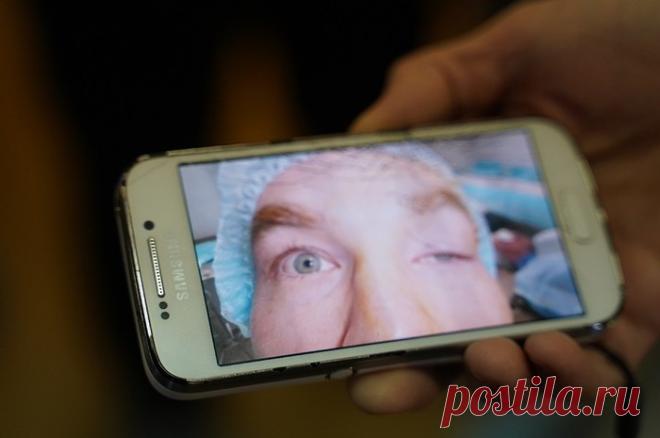 Самарские врачи за полчаса «открыли» глаз итальянцу
Флавио Фриджерио много лет страдал из-за старой детской травмы, но европейские медики ничего не могли поделать Миланец Флавио Фриджерио долгие 25 лет видел окружающий мир только «вполглаза». Виной всему был птоз – опущение верхнего века. В 10-летнем возрасте он получил травму – неудачно упал и дужкой очков повредил мышцу над левым глазом. С тех пор […]
Читай дальше на сайте. Жми подробнее ➡