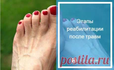Перелом пальца на ноге симптомы - лечение