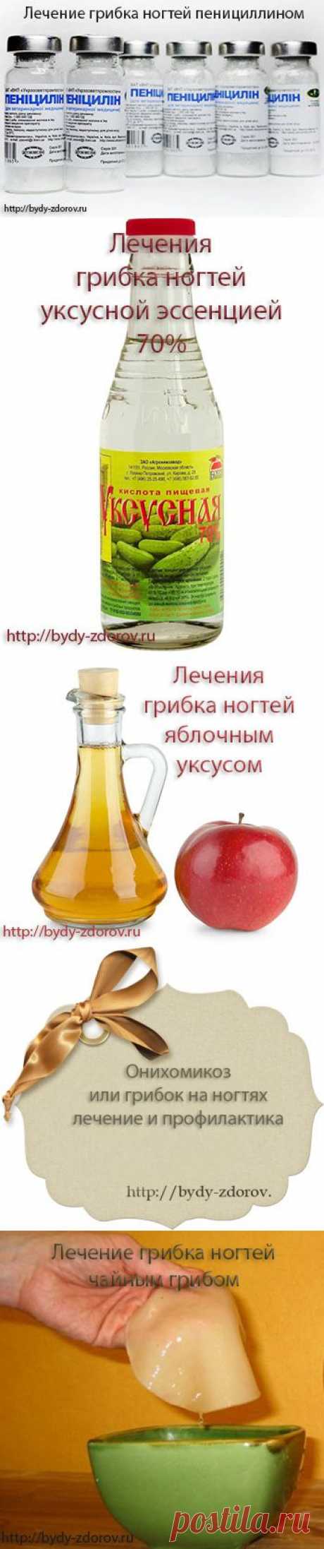 Грибок на ногтях, вылечим | Народные способы лечение грибка |