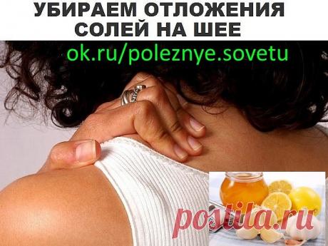 УБИРАЕМ ОТЛОЖЕНИЕ СОЛЕЙ НА ШЕЕ

Отложение солей на шее называют остеохондрозом шейного отдела позвоночника. Вследствие того, что шейный отдел позвоночника является весьма важной частью организма, нарушения в этой области приводят к серьезным нарушениям всего организма.

Область шеи является местом сосредоточения сосудов и нервов, питающих ткани шеи, лица, черепа. Кроме того, вследствие защемления нервных окончаний начинаются головные боли, онемение конечностей, слабость мы...