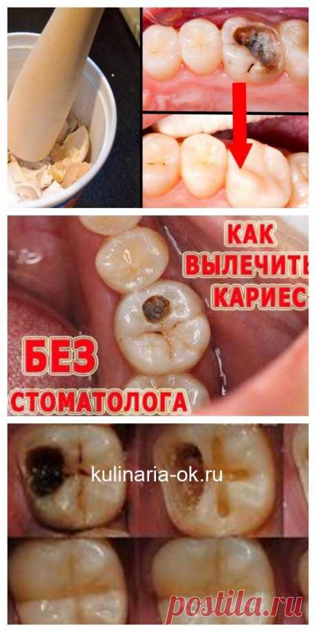 Врачи скрывают это! Избавьтесь от кариеса с помощью обычной скорлупы. Это 100% работает! Вот что нужно делать…