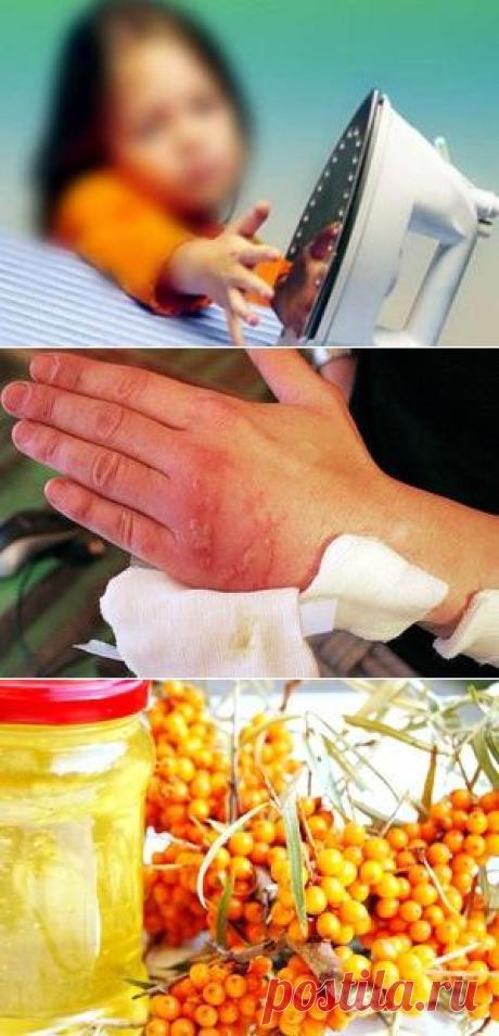 Ожоги - лечение в домашних условиях народными средствами.