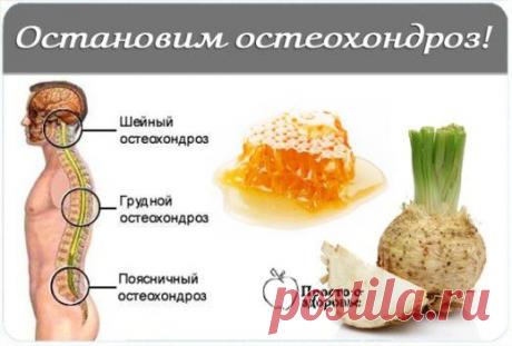 Остановим остеохондроз | Golbis