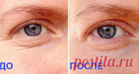 Эти масла убирают морщины вокруг глаз — Мир интересного