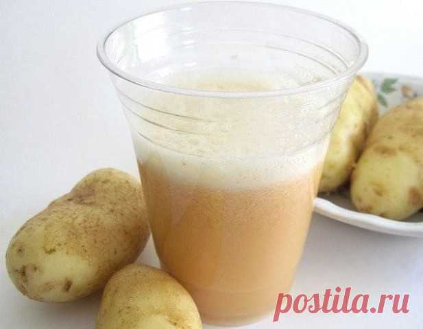 Лечим поджелудочную железу картофельным соком

Картофель при лечении панкреатита используется довольно часто. Этот овощ обладает диетическими, а главное, заживляющими, противовоспалительными действиями. Также картошка отлично снимает спазм. Готовить его можно путем отваривания или запекания, конечно, без добавления специй.

Но гораздо полезнее картофельный сок, который обволакивает слизистую, препятствуя чрезмерному образованию пищеварительных ферментов. Ведь они крайне не...