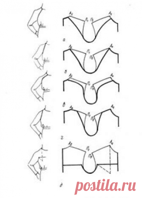Sleeves.