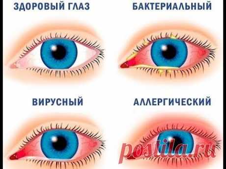 Как ставить пиявки на глаза.