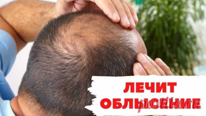 Невероятная маска от выпадения волос и облысения Густые, красивые волосы – предмет гордости для женщин и мужчин. Однако, если в силу каких – либо причин густота волос теряется, наблюдается повышенное выпадение волос – это настоящая проблема.Я вам покажу супер-маску, которая действительно борется с этой проблемой. Для нее...