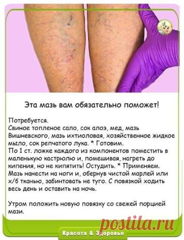 Мазь от варикоза