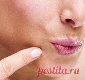 Заговор от папиллом - лечение без операций. - МирТесен