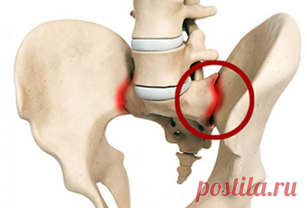 Артрит или Артроз: ищем разницу и лечимся правильно 
О здоровье суставов мы не задумываемся до тех пор, пока они не начнут «гудеть», болеть, ныть и хрустеть. А дальше ... дальше мы сами себе ставим диагноз и сами себя лечим, пока болезнь не войдет в ст…