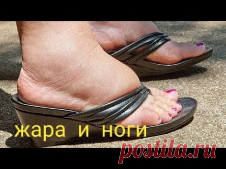 Жара. Отеки ног, тяжесть в ногах, боли и судороги при жаре. Как пережить жару ногам?