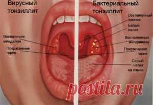 ЧИСТИМ МИНДАЛИНЫ И НЕ БОЛЕЕМ.