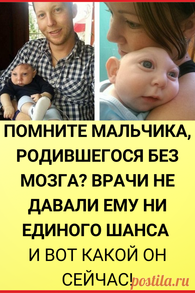 Помните мальчика, родившегося без мозга? Врачи не давали ему ни единого шанса и вот какой он сейчас!