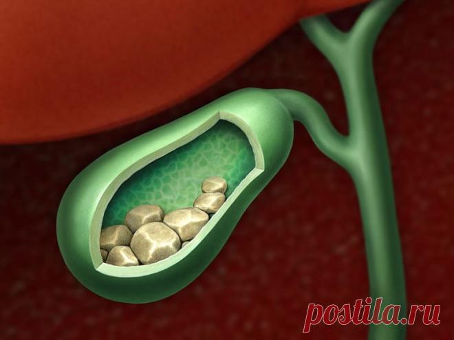 Как прожить без камней в желчном пузыре / Будьте здоровы