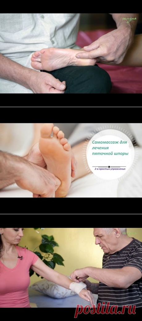 Пяточная шпора. Лечение в домашних условиях - YouTube