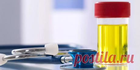 15 показателей в анализе мочи, по которым можно заметить болезни | ЛДЦ «Кутузовский» | Яндекс Дзен