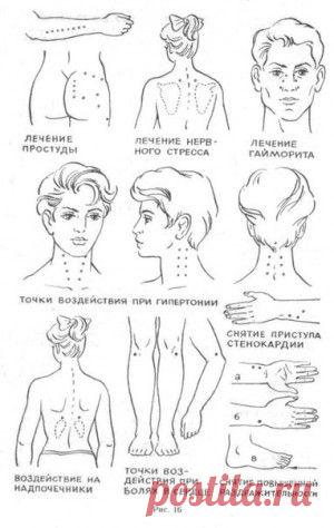 Ранункулюс (садовый лютик)