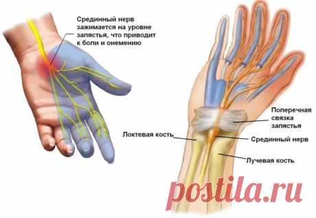 Что важно знать всем, кто работает за компьютером Ранняя диагностика и профилактика проблемы – ключевые факторы для сохранения и умножения своего здоровья.