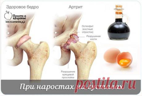 При наростах на суставах.