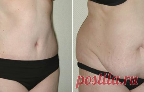 Впечатляющий эффект от жиросжигающего салата: возрастной жир ушел за 15 дней

Недавно, я узнала о жиросжигающем салате. Называется он &quot;Щётка&quot; или &quot;Метелка&quot;. Идеально подходит для тех, кто мечтает о стройной фигуре. Это блюдо состоит из трех овощей: сырая свекла, белокочанная капуста и сырая морковь. Все эти овощи содержат в своем составе клетчатку, а это самый мощный жиросжигатель.