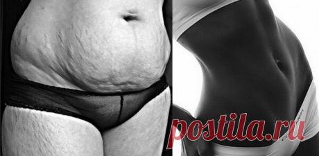 Как приготовить жиросжигающий чай: жир на животе растворился за 7 дней + скинула 4 кг

С проблемой лишнего веса не знакомы лишь редкие женщины, которых, по моему мнению, природа наградила отличным метаболизмом. К сожалению, мне не повезло, и все лишние калории, которые я позволила себе в течение дня с неимоверной скоростью откладываются в виде складок на талии и в других проблемных женских зонах.