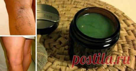 Средство от варикоза по бабушкиному рецепту: первые результаты заметны почти сразу! 
Генетическая предрасположенность, гормональные изменения, отсутствие должной физической нагрузки, возраст — всё это причины развития варикоза.

Варикоз — это то заболевание, которое нужно вовремя выя…